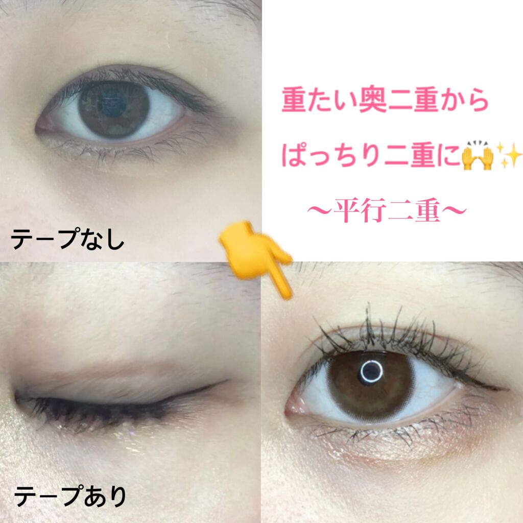 のびーるアイテープ（絆創膏タイプ、レギュラー）/DAISO/二重まぶた用アイテムを使ったクチコミ（1枚目）