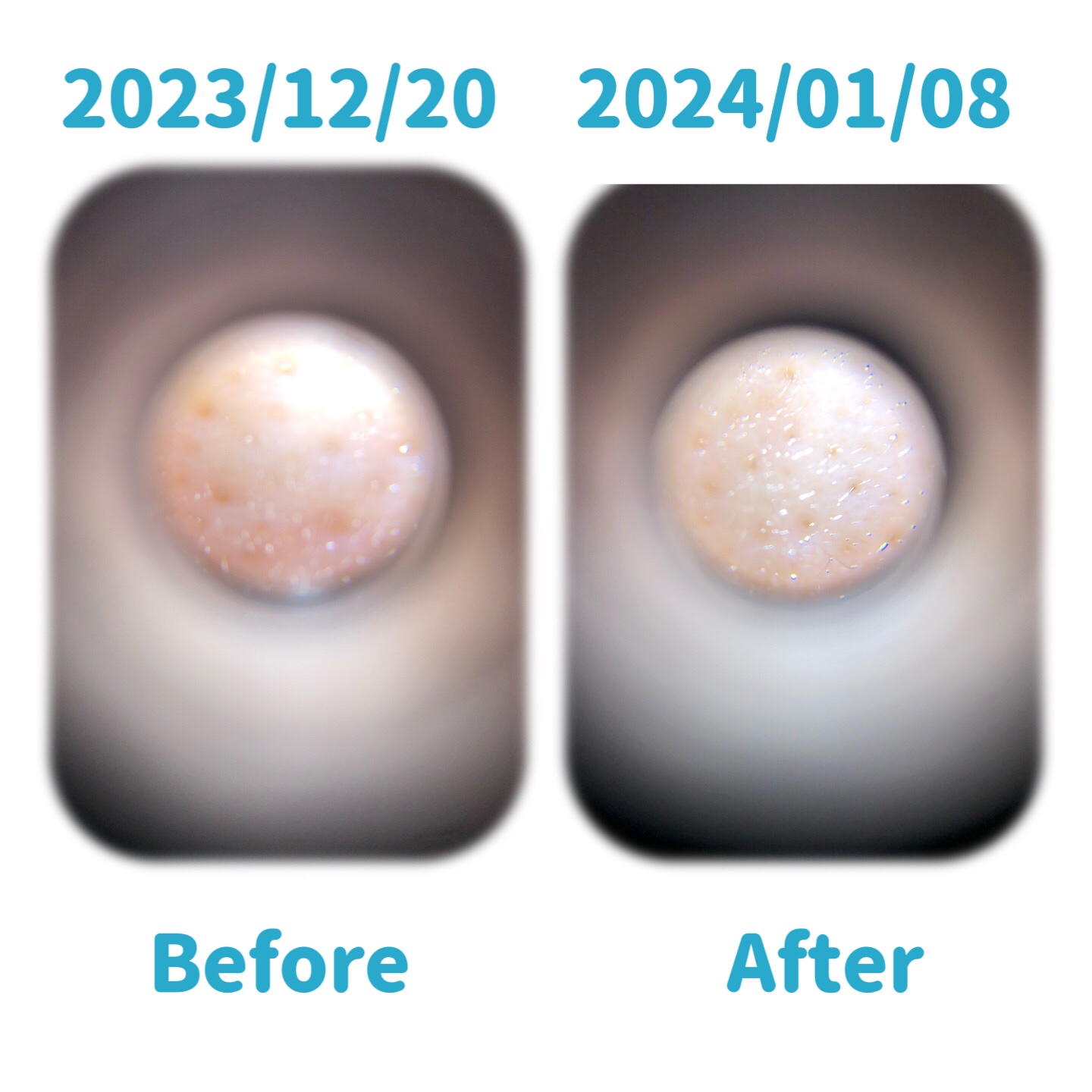 リードルショット ビタライト クリーム/VT/フェイスクリームを使ったクチコミ（3枚目）