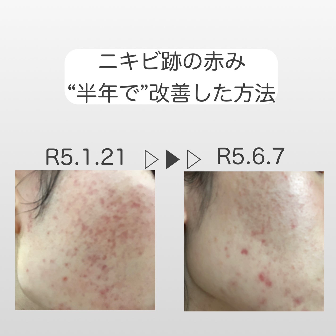 N10+Z1フェイスセラム /The Ordinary/美容液を使ったクチコミ(1枚目)