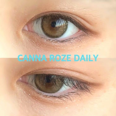  こんにちは🥺




ついに今日……






CANNA ROZE DAILY （カンナロゼデイリー）


届きましたああぁあぁあ！！！！！！






iｰDOLレンズ様からあの橋本環奈ちゃん