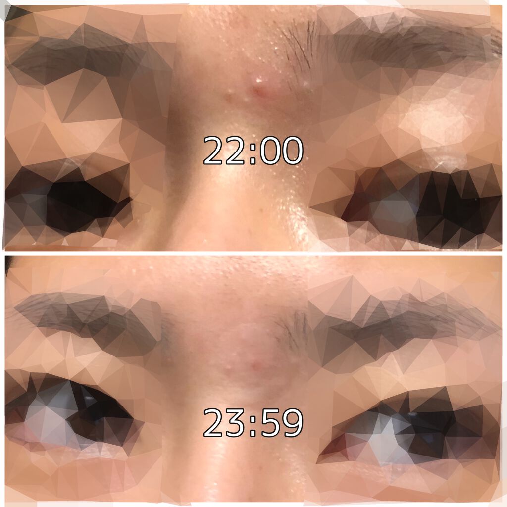 トラブルキュア/美肌ファクトリー/シートマスク・パックを使ったクチコミ(3枚目)