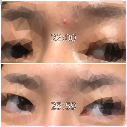 トラブルキュア/美肌ファクトリー/シートマスク・パックを使ったクチコミ(3枚目)