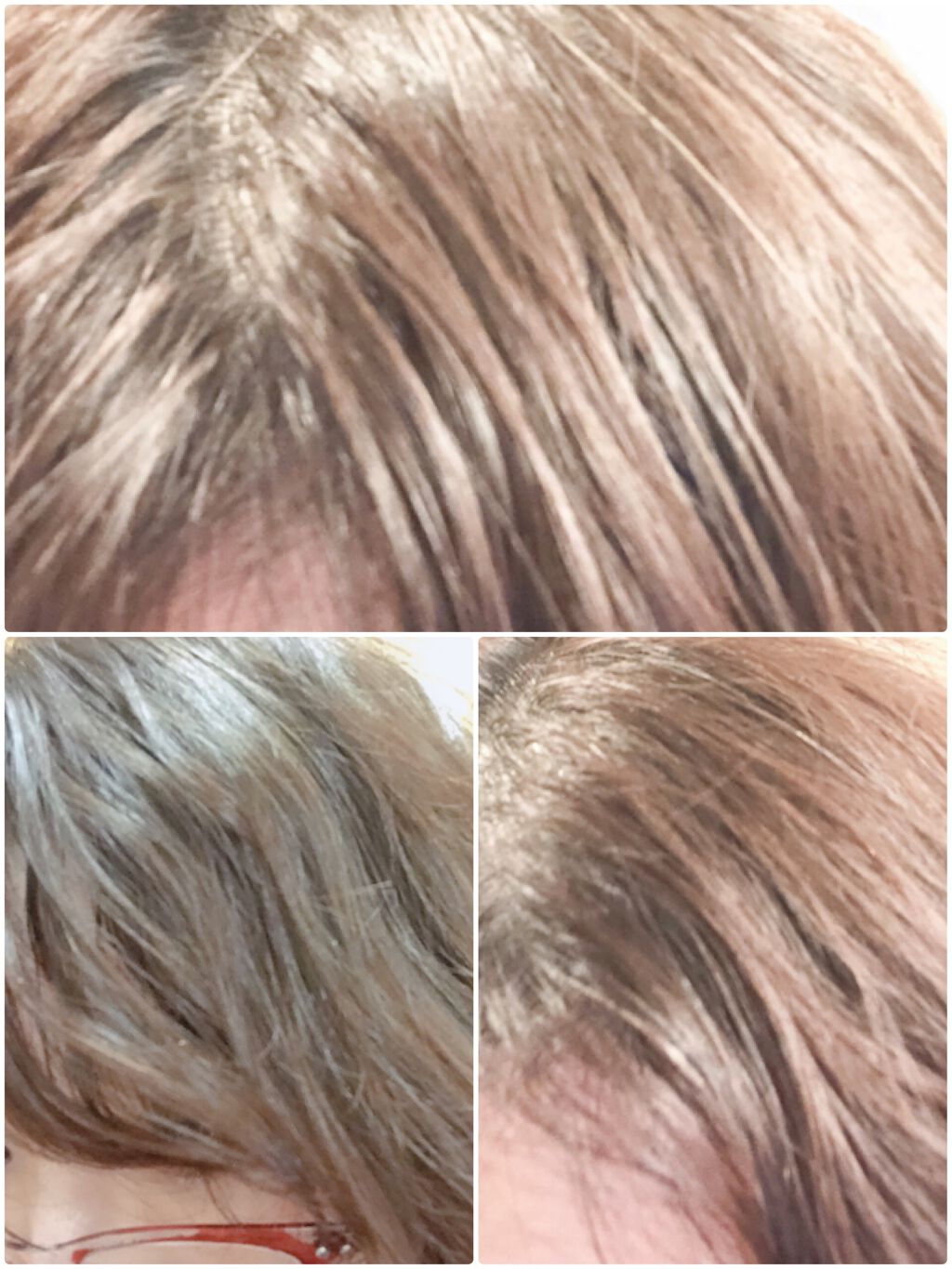 温感ヘッドスパトリートメント/TRICORE/頭皮トリートメントを使ったクチコミ(4枚目)