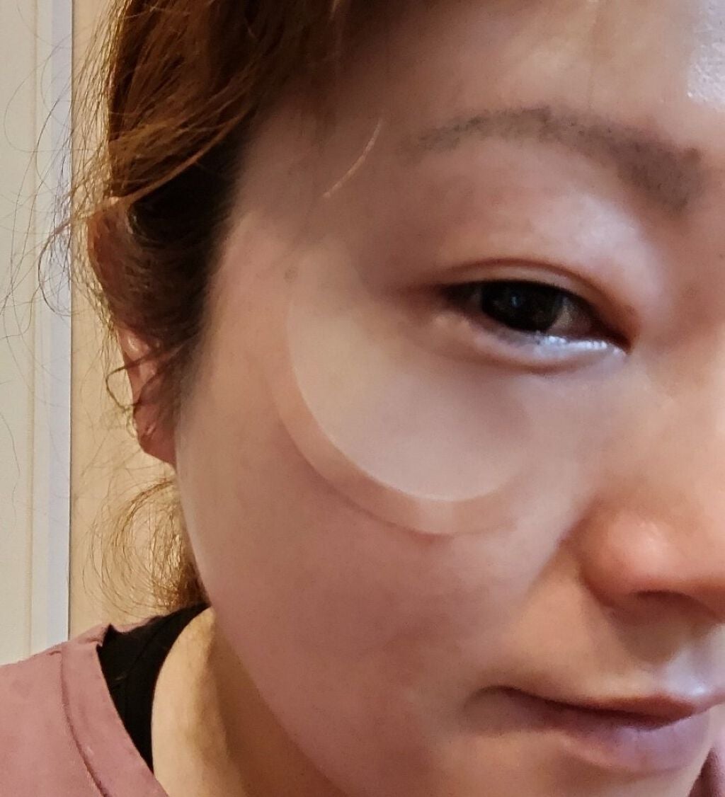 MICRO NEED ヒアルロン酸 セラムパッチ/bijoːu(ビジュー)MICRO NEED/シートマスク・パックを使ったクチコミ(5枚目)