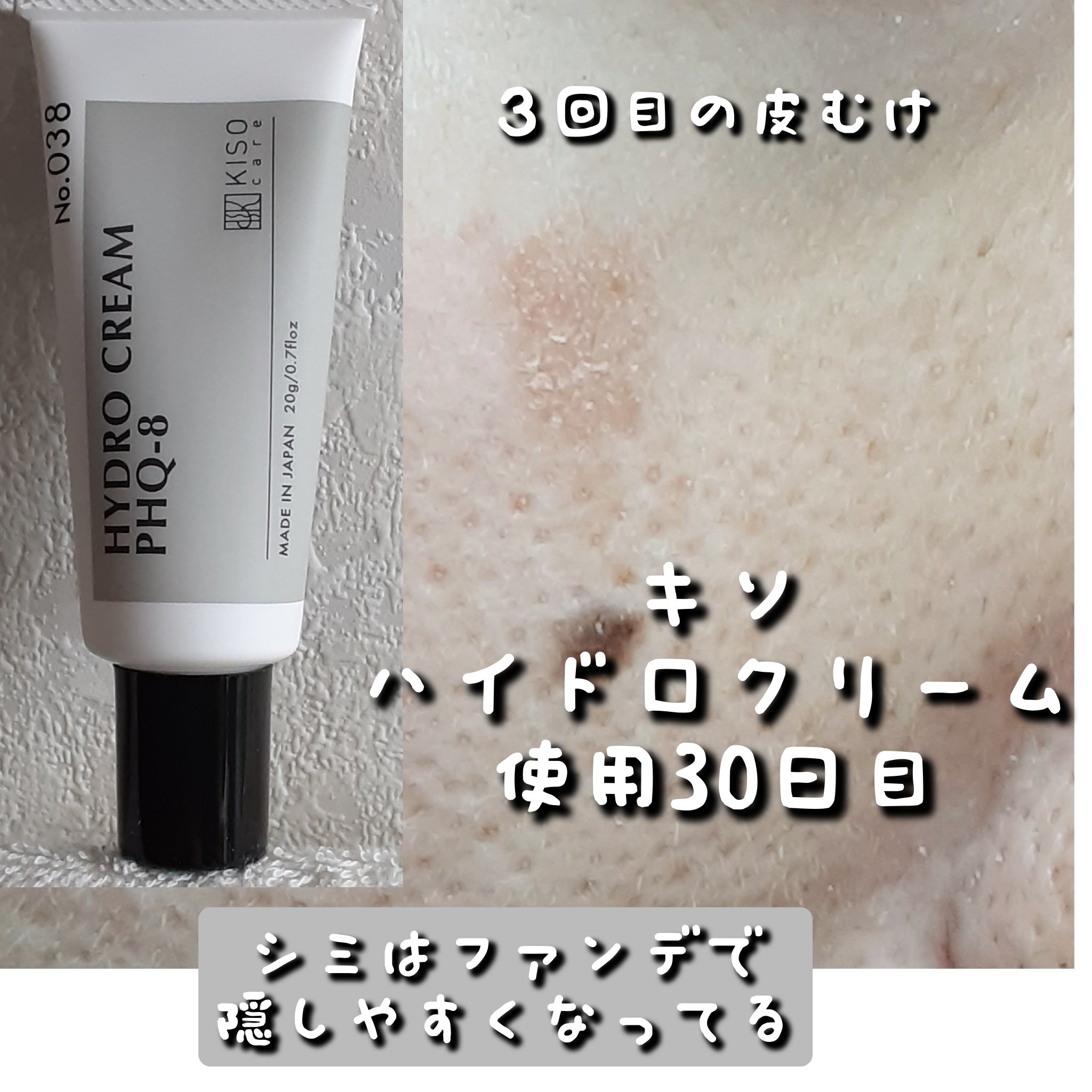ハイドロクリームPHQ-8/KISO/美容液を使ったクチコミ（1枚目）