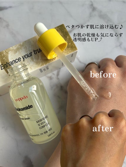 ナイアシンアミド 3% クリーム/yeppda/フェイスクリームを使ったクチコミ(2枚目)
