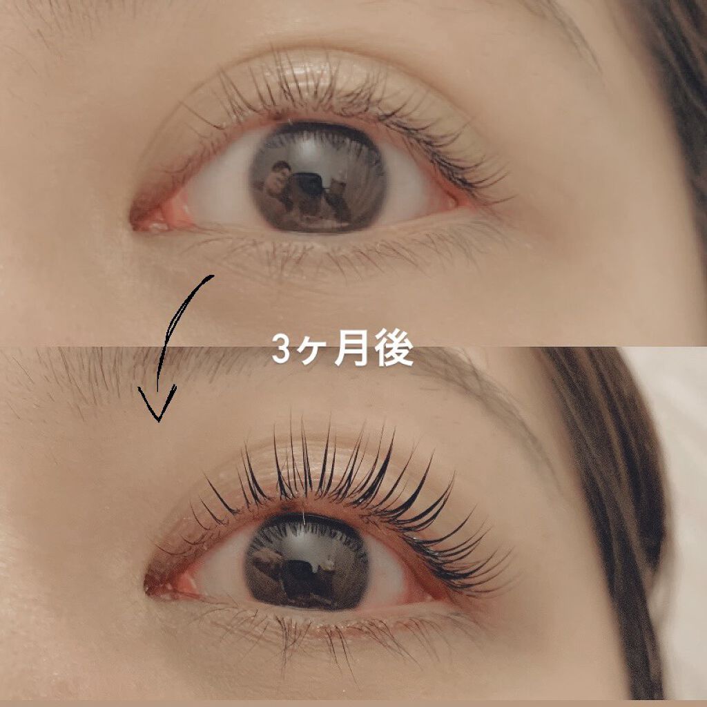 エグータム/アルマダスタイル/まつげ美容液を使ったクチコミ（1枚目）