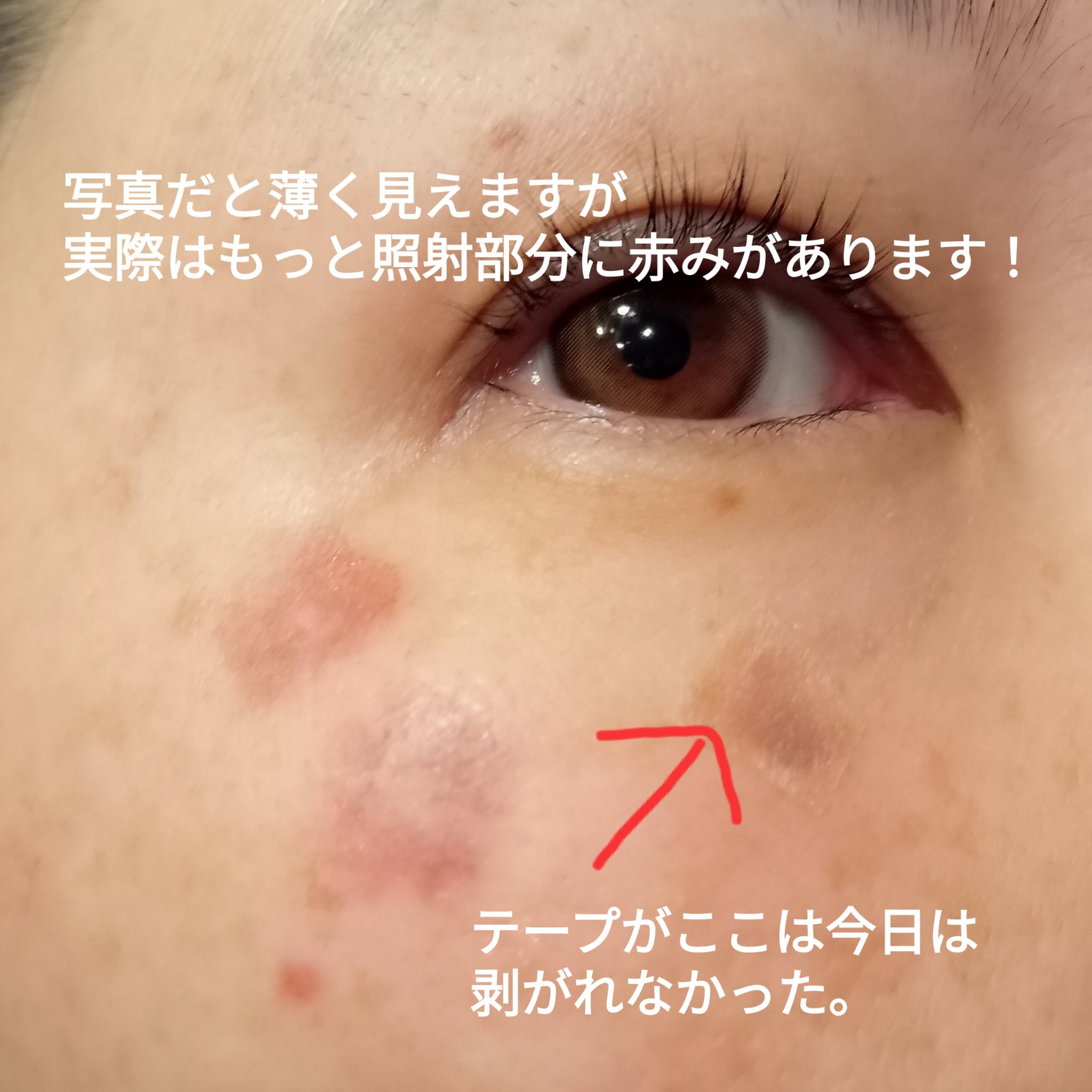 を使ったクチコミ（2枚目）