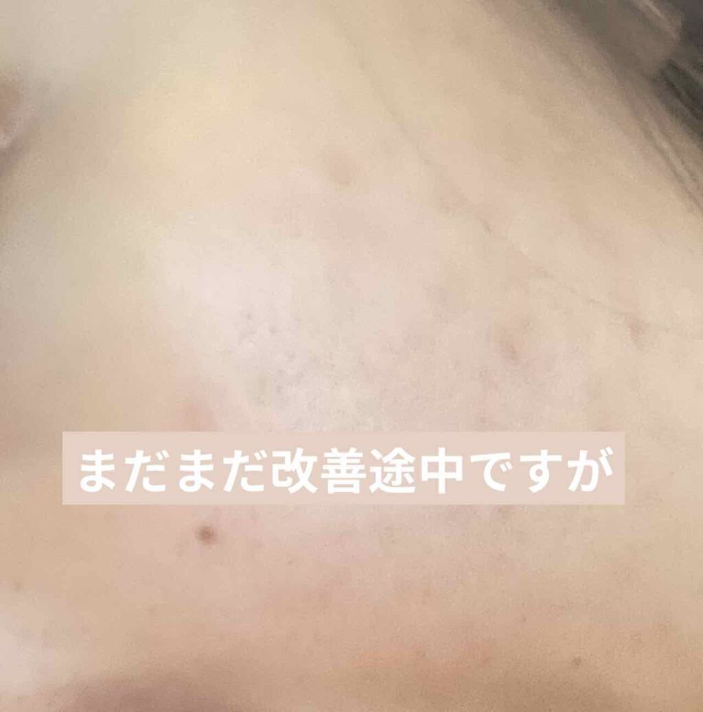 ホワイトニングクリア ローション/d プログラム/化粧水を使ったクチコミ(2枚目)