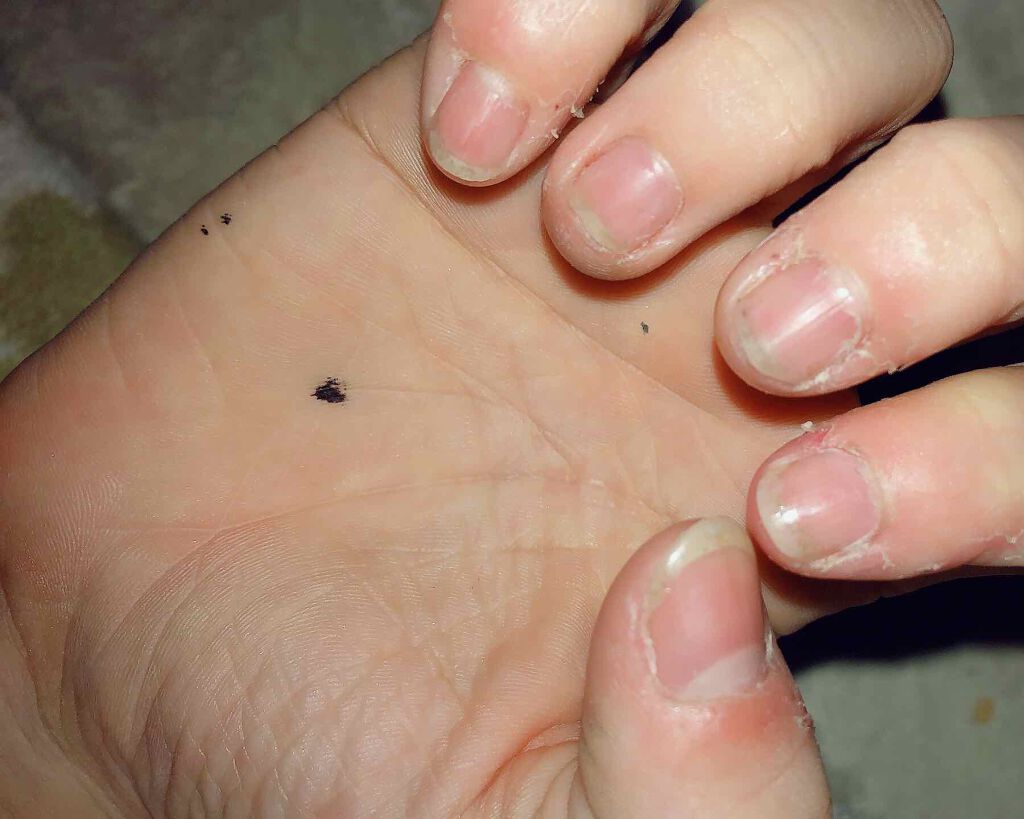 カラフルネイルズ ネイルハードナー/キャンメイク/ネイルトップコートを使ったクチコミ（3枚目）