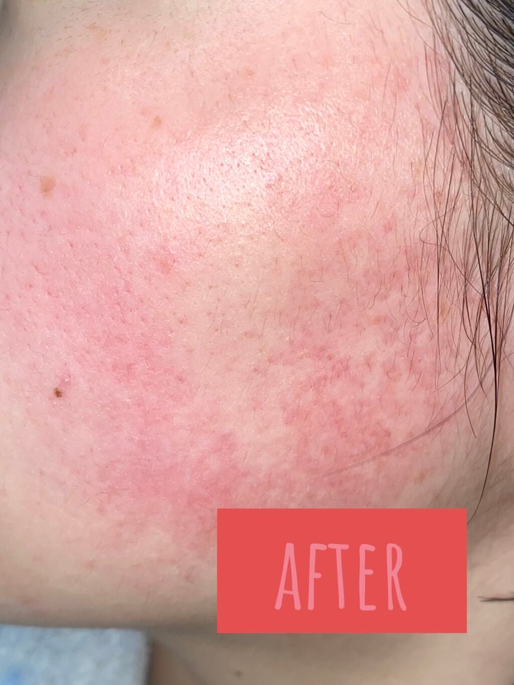 マデカソ 美容液/A’pieu/美容液を使ったクチコミ(3枚目)