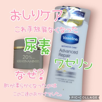 コーワ20%尿素配合クリーム(医薬品)/ケラチナミン/その他を使ったクチコミ(1枚目)
