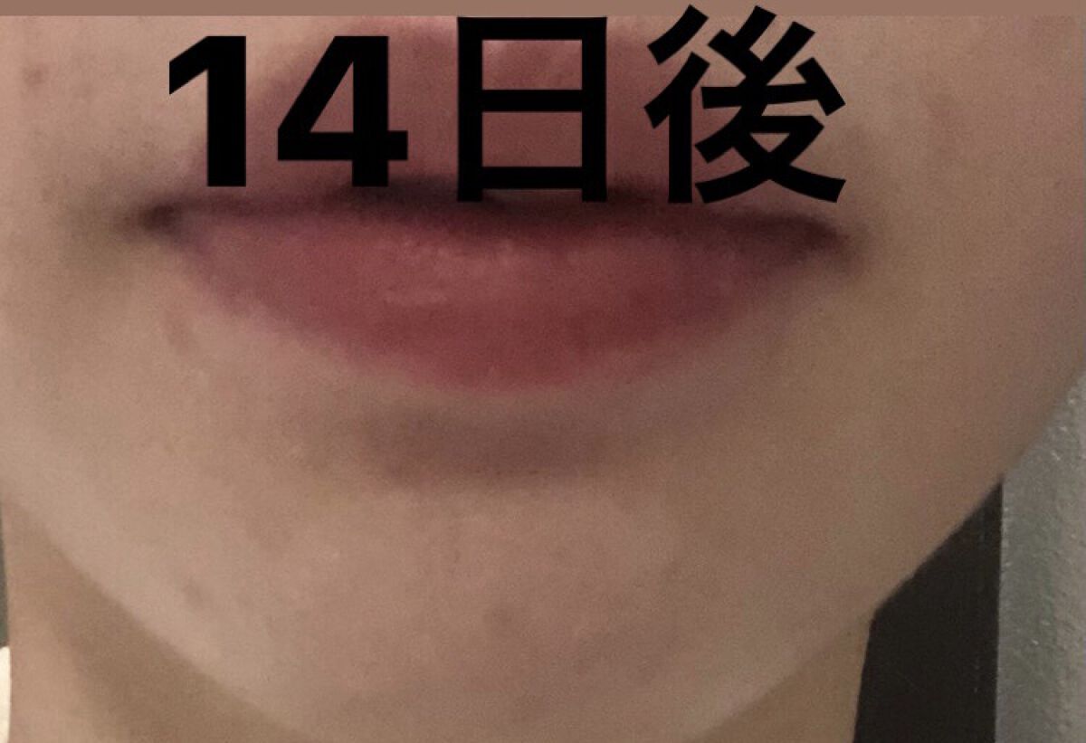 ドクダミ 77 スージングトナー/Anua/化粧水を使ったクチコミ（3枚目）