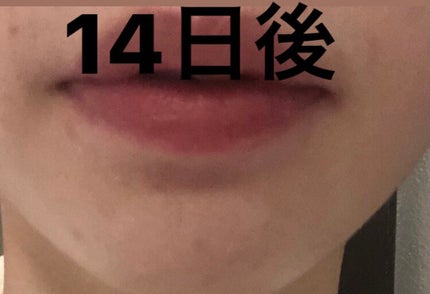 ドクダミ 77 スージングトナー/Anua/化粧水を使ったクチコミ(3枚目)