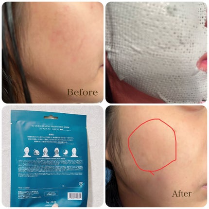 トーンアップホワイト マッドマスク/by : OUR/シートマスク・パックを使ったクチコミ(5枚目)