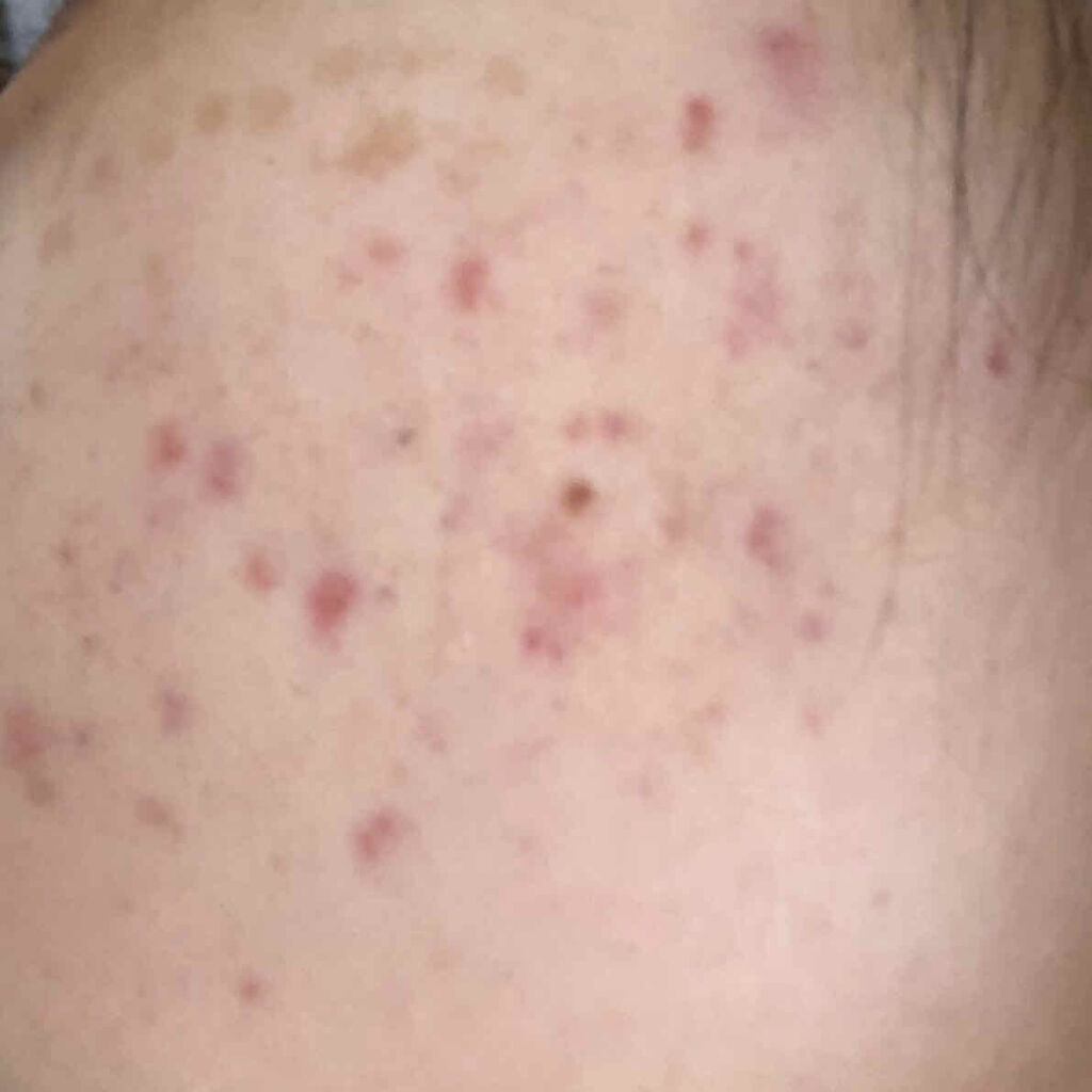 ヴァセリン アドバンスドリペア ボディローション 無香料/ヴァセリン/ボディローションを使ったクチコミ（2枚目）