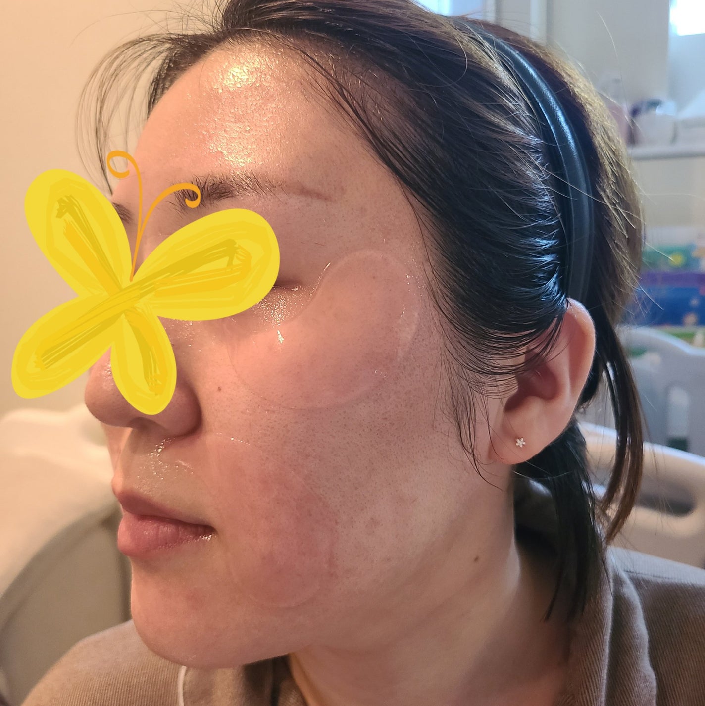 RXザ・ペプチドコラーゲン ハイドロゲルアイパッチ/COSRX/アイケア・アイクリームを使ったクチコミ(4枚目)