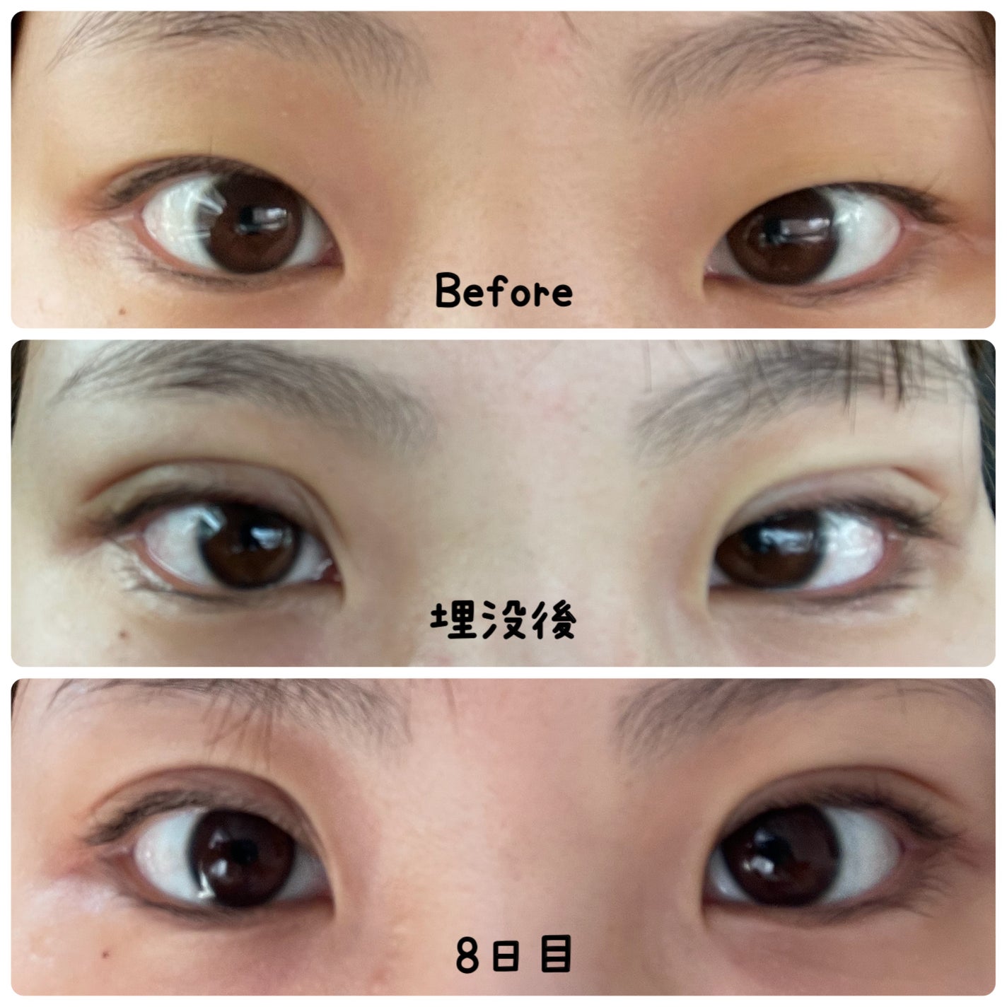 ナイトアイボーテ/StreeTrend/二重まぶた用アイテムを使ったクチコミ(9枚目)