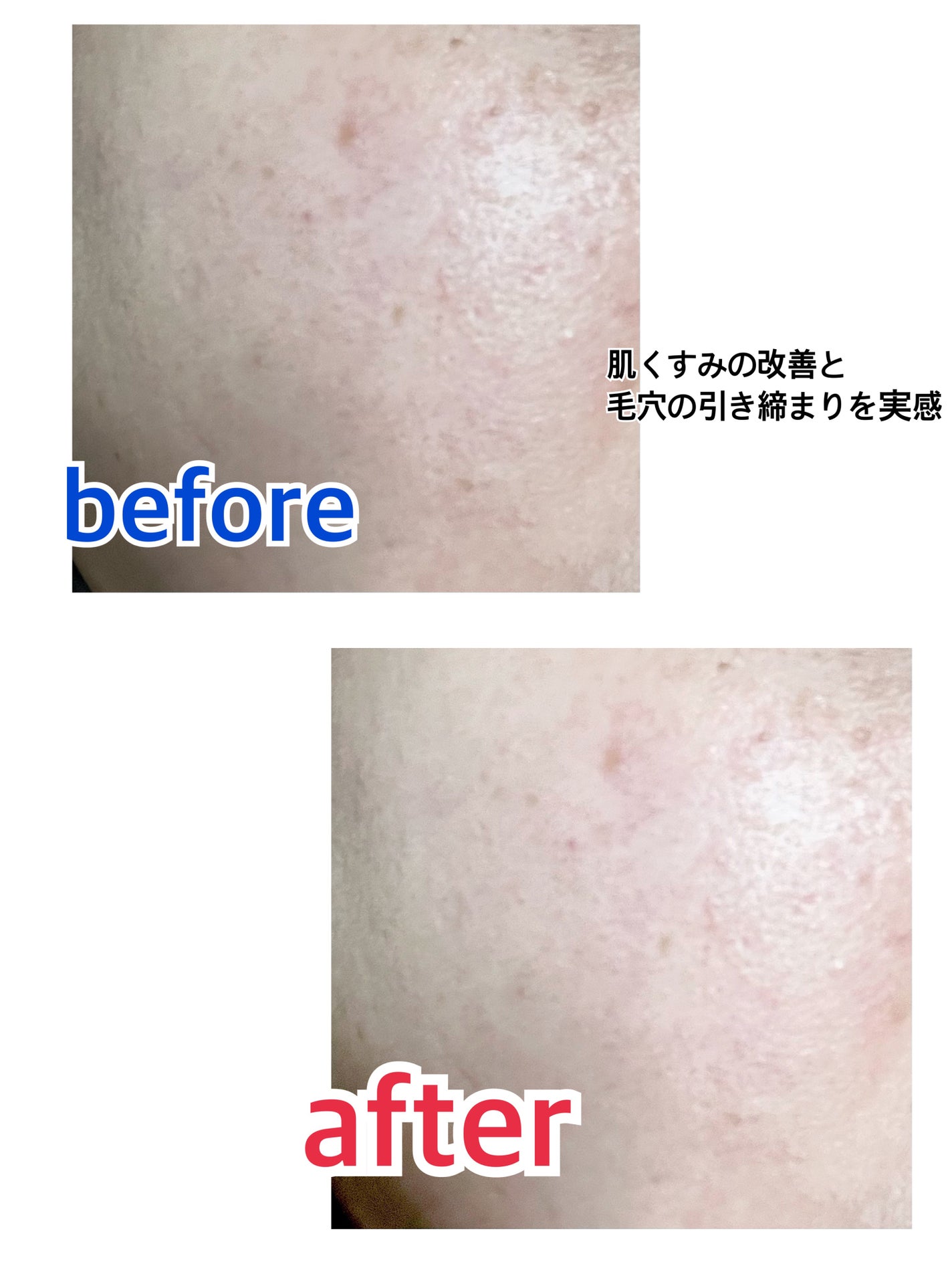 リードルショット100/VT/美容液を使ったクチコミ(6枚目)