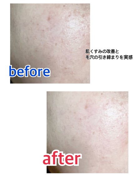 リードルショット100/VT/美容液を使ったクチコミ(6枚目)