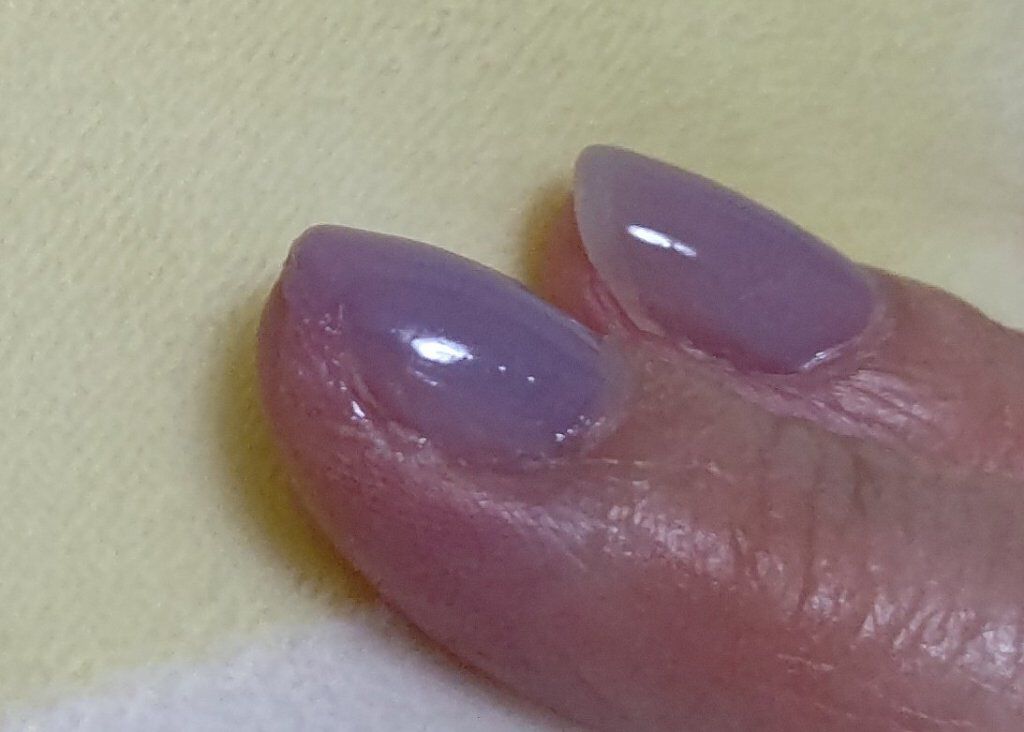 スプリットリペアN/ネイルネイル/ネイルオイル・トリートメントを使ったクチコミ（2枚目）