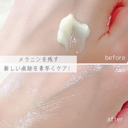 5番 白玉グルタチオンCメラゼロクリーム/numbuzin/フェイスクリームを使ったクチコミ(3枚目)