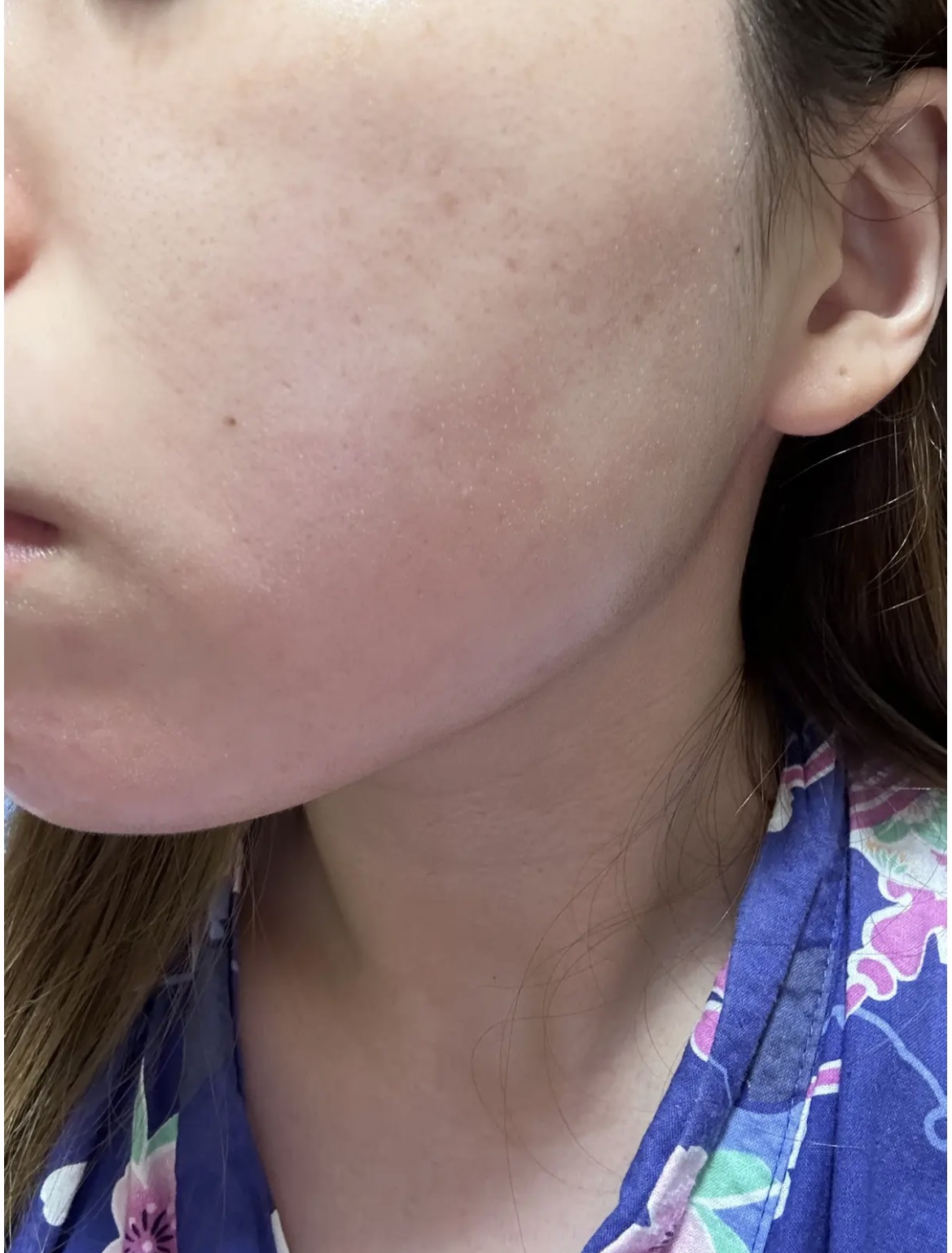 トゥインクルブラック アクアモイスチャーシートマスク/ALFACE+/シートマスク・パックを使ったクチコミ（3枚目）