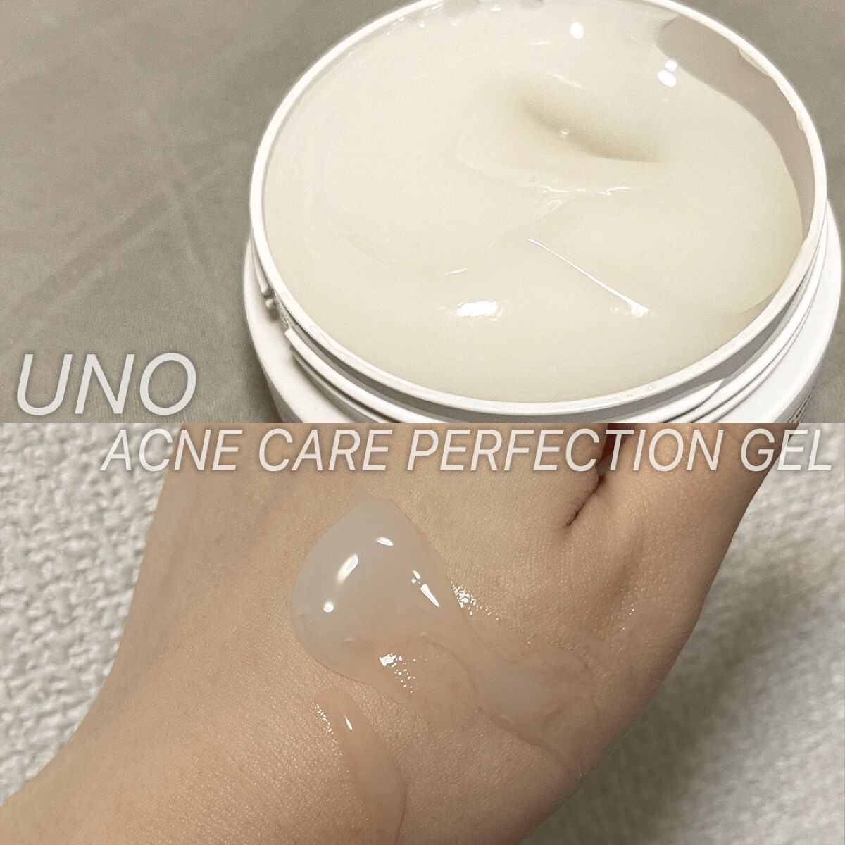 ウーノ アクネケア パーフェクションジェル fA (医薬部外品)/UNO/オールインワン化粧品を使ったクチコミ(2枚目)