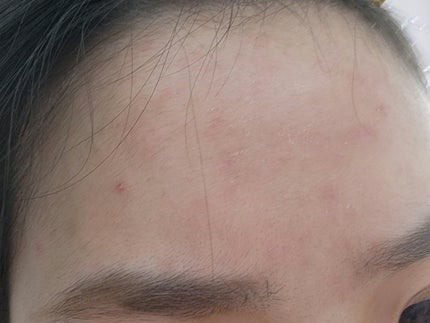 イプノス シーバムクリア リペアクリーム/ACSEINE/フェイスクリームを使ったクチコミ(5枚目)