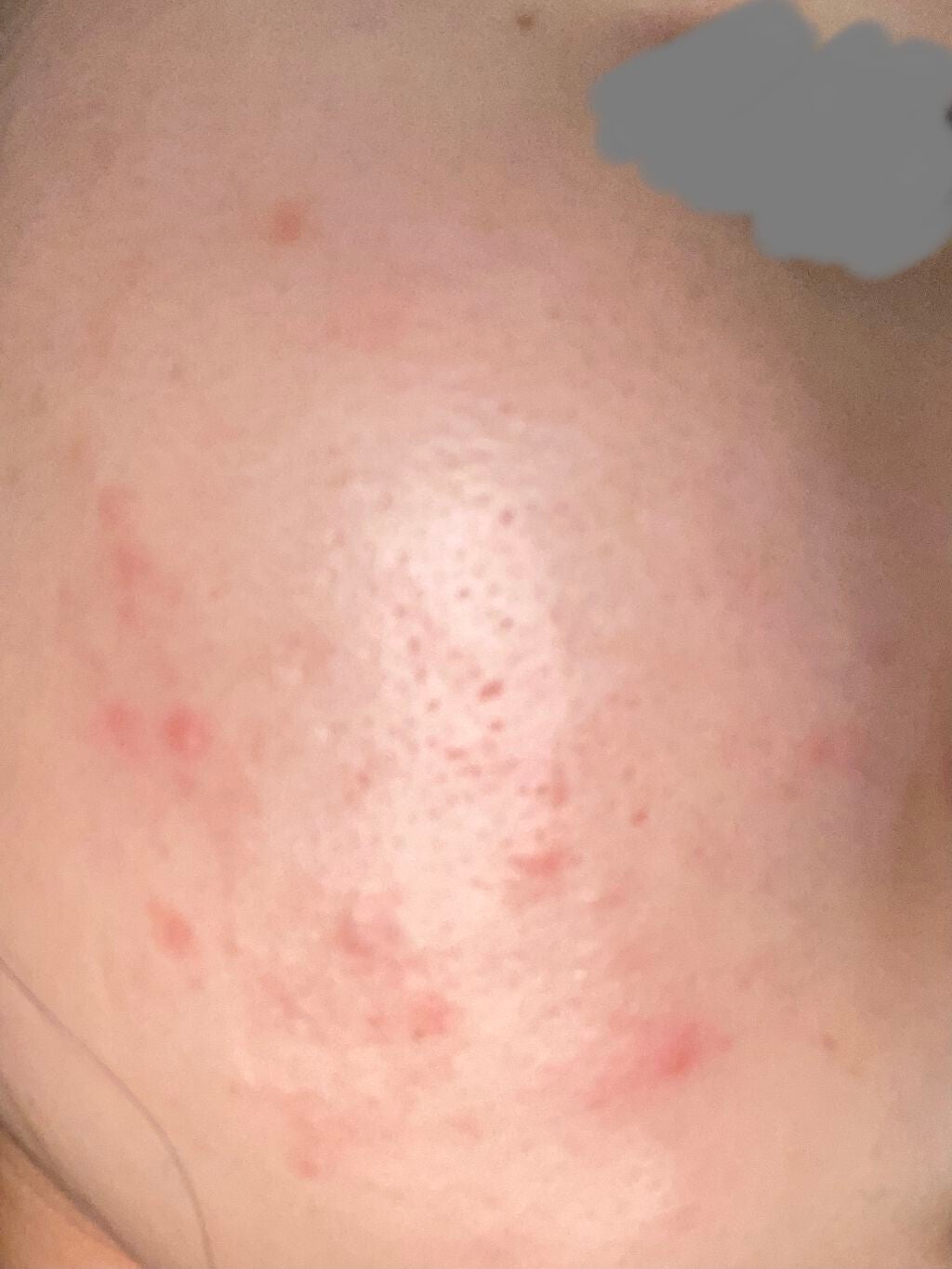 ACアクティブ トライアルセット/NOV/トライアルキットを使ったクチコミ(4枚目)