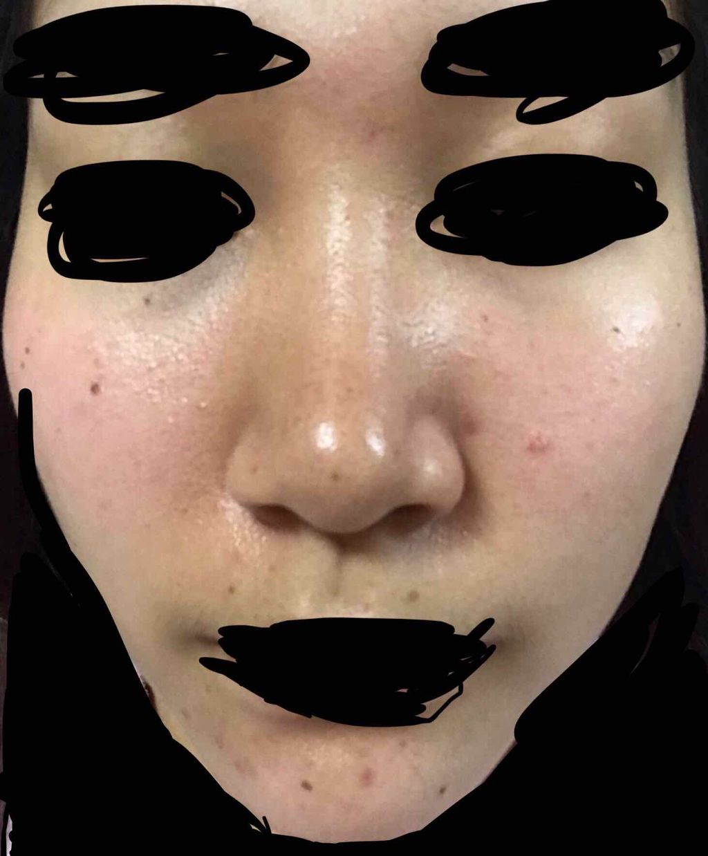 薬用 しみ 集中対策 美容液/メラノCC/美容液を使ったクチコミ(1枚目)