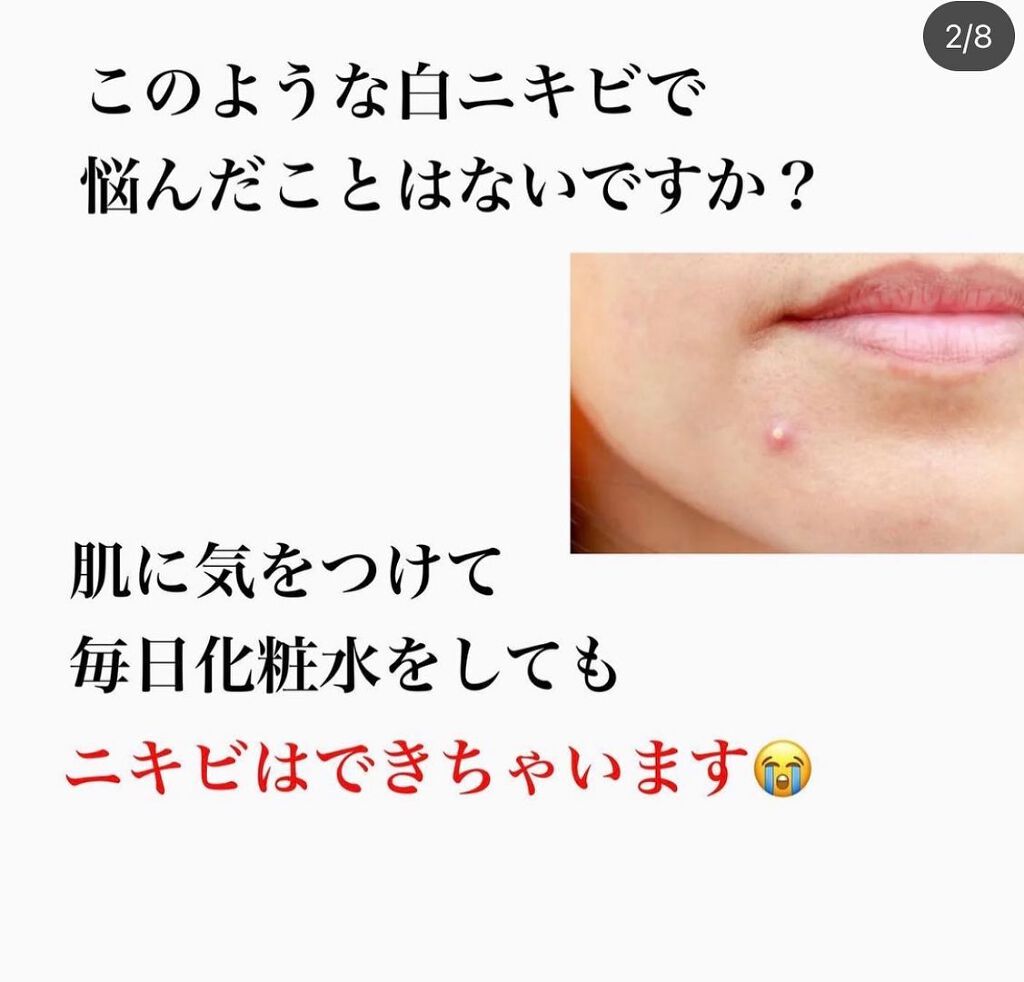 kento@パーソナルスキンケア on LIPS 「こんばんは!けんとです!ニキビケアは大事です!この冬は乾燥して..」(2枚目)