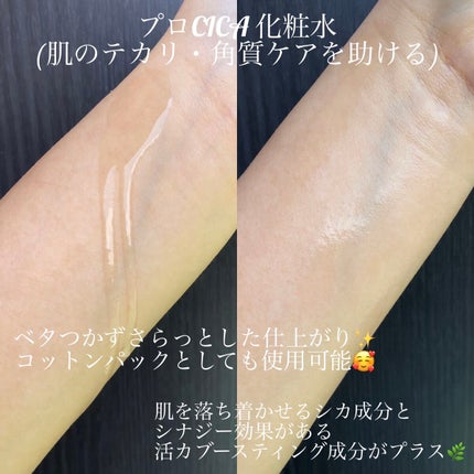 プロ シカ センテラ アジアティカ タイガー スキン/VT/化粧水を使ったクチコミ(3枚目)