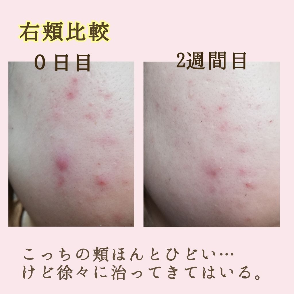 ザ・タイムR アクア/IPSA/化粧水を使ったクチコミ（2枚目）