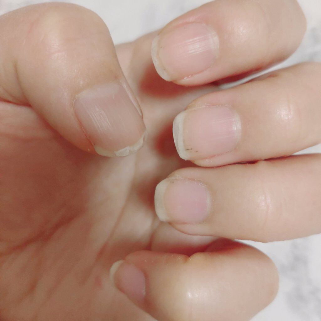 エルファー ネイルキッスB/DAISO/除光液を使ったクチコミ（2枚目）