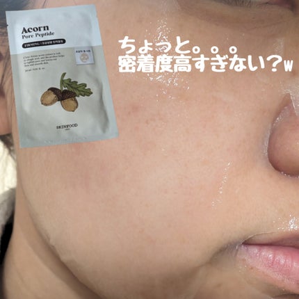 どんぐりペプチド マスク/SKINFOOD/シートマスク・パックを使ったクチコミ(1枚目)