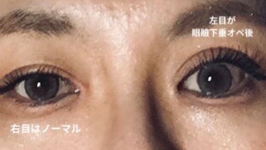 Eyebrow&Eyelash Serum/NUNSSUP JARA/まつげ美容液を使ったクチコミ（3枚目）