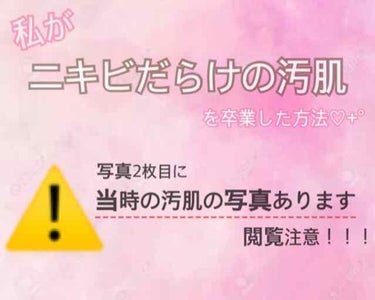 2年ほど前、肌( 特に頬 )がすごく荒れていました。
⚠️ 当時の汚肌の写真が2枚目に載っています。閲覧注意。

しかし、今は2枚目の写真のAfterように、ニキビ跡は気になるけれど、ニキビそのものはほ