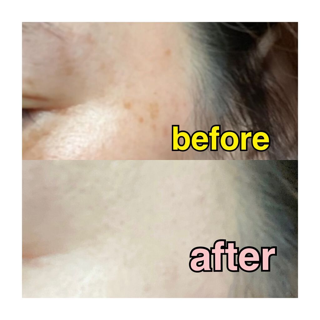 デザイニング コンシーラー/ブリリアージュ/リキッドコンシーラーを使ったクチコミ(5枚目)