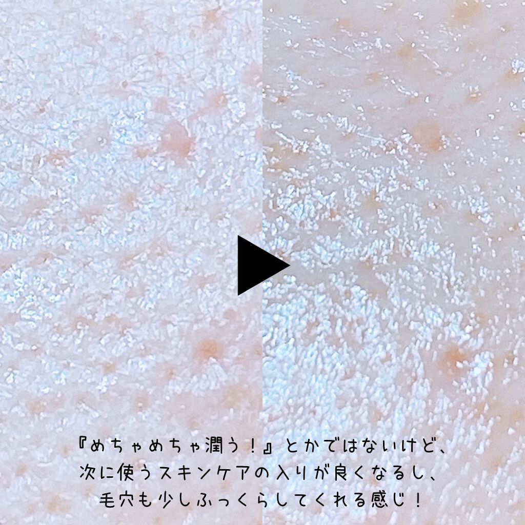 えび松(春br) on LIPS 「株式会社ピー・エイ・アイ・ジャパン様よりアースチャイルド ..」(5枚目)