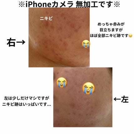 CICA ダブルミスト/VT/ミスト状化粧水を使ったクチコミ(2枚目)