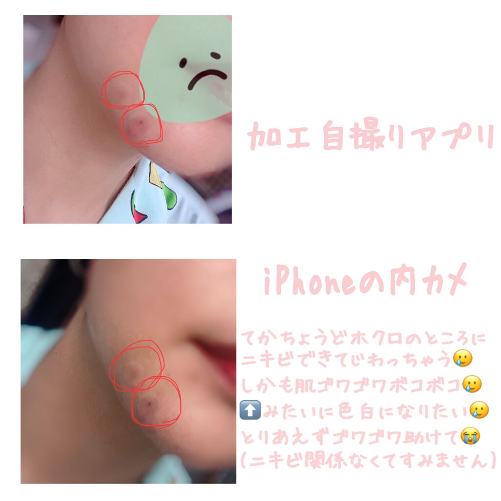  A-zero Shot スキンドレッシングパッチ/MEDIHEAL/シートマスク・パックを使ったクチコミ（2枚目）