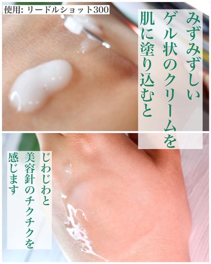 リードルショット300/VT/美容液を使ったクチコミ(4枚目)