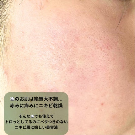 エクソソームシカセラム/MEDICUBE/美容液を使ったクチコミ(5枚目)