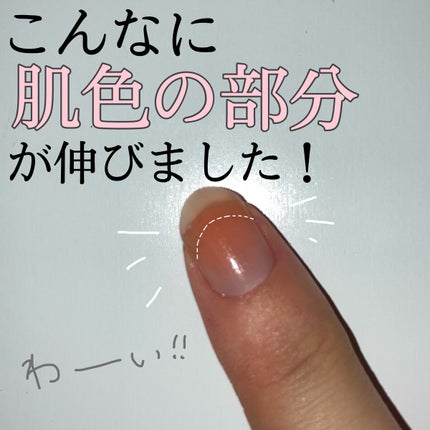 キューティクルオイル/ネイルホリック/ネイルオイル・トリートメントを使ったクチコミ(1枚目)