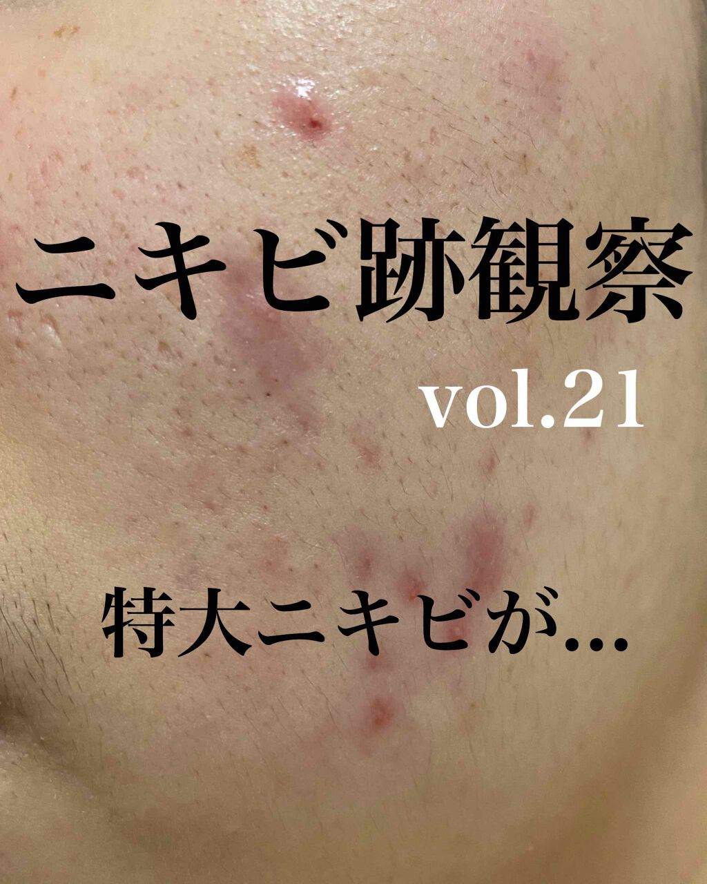 敏感肌用薬用美白美容液/無印良品/美容液を使ったクチコミ(1枚目)