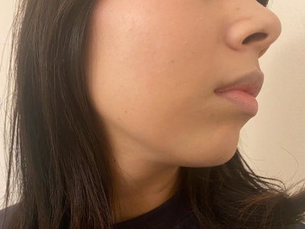 セラムリキッドファンデーション/& WOLF/リキッドファンデーションを使ったクチコミ(4枚目)