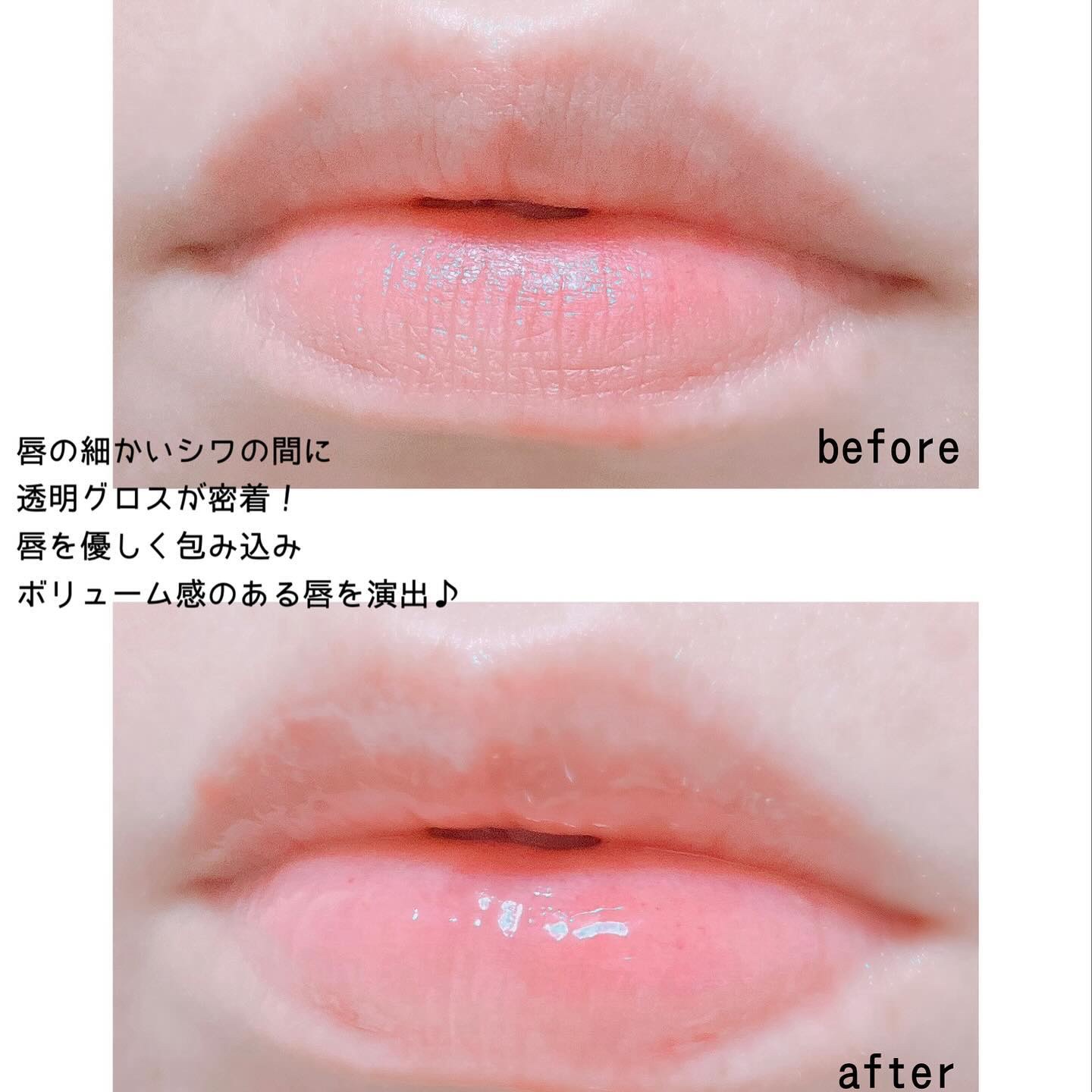 リードルS リッププランパービギナー/VT/リッププランパーを使ったクチコミ（2枚目）