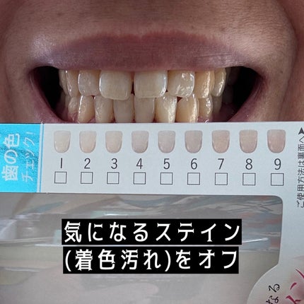 アパガードセレナ/アパガード/歯磨き粉を使ったクチコミ(7枚目)