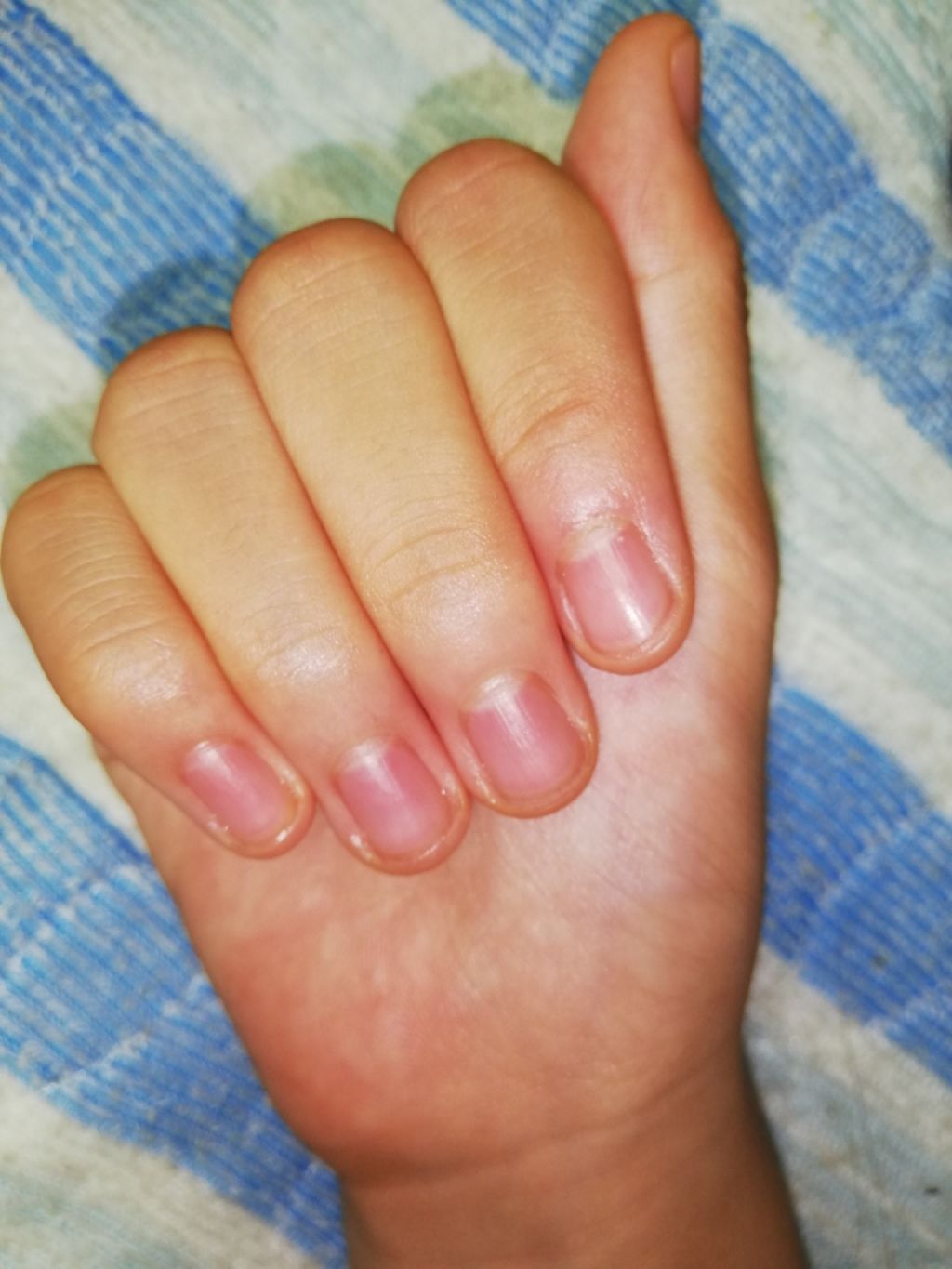 AC キューティクルオイル/AC MAKEUP/ネイルオイル・トリートメントを使ったクチコミ(3枚目)